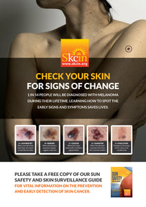 Skin Cancer Prevention A3 Showcard, highlighting the importance of Sun Safety. All our showcards come with a strut attached to the rear, they can either be wall mounted or counter/table top displayed and are made from a durable, solid board that is gloss laminated - ensuring your display looks smart and professional and will stand the test of time.